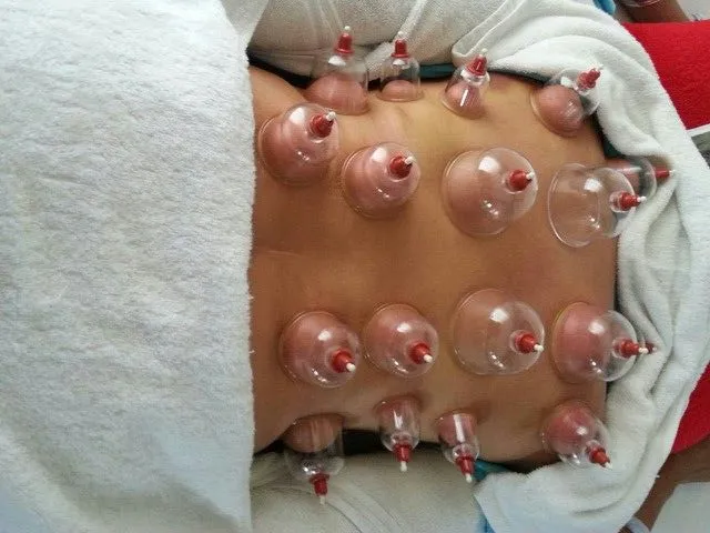 Terapia Hixhama (300 ore)