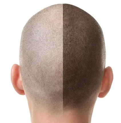 Kursi Makeup Permanent i Aureolave & Zonave të Rëna të Flokëve (150 ore)